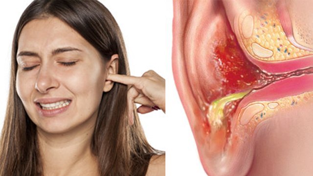 कान में बार-बार खुजली होने का कारण | कान में बार-बार खुजली क्यों होती है | Boldsky