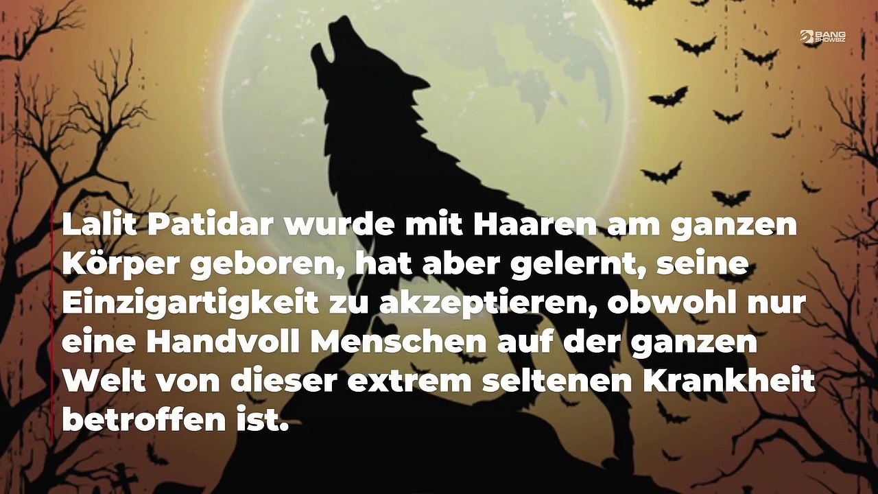 Teenager in Indien leidet am Werwolf-Syndrom