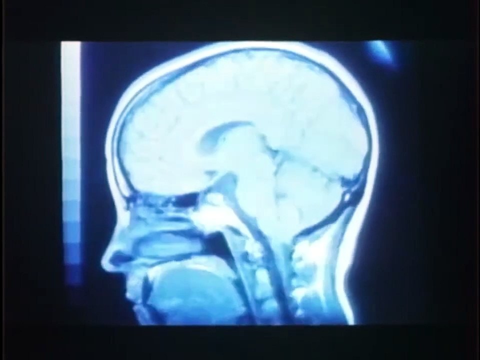 Brain Dead | movie | 1990 | Official Trailer