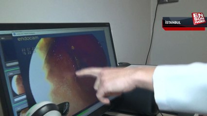 Gaziosmanpaşa’da hapşıran kadın ağzına aldığı iğneyi yuttu