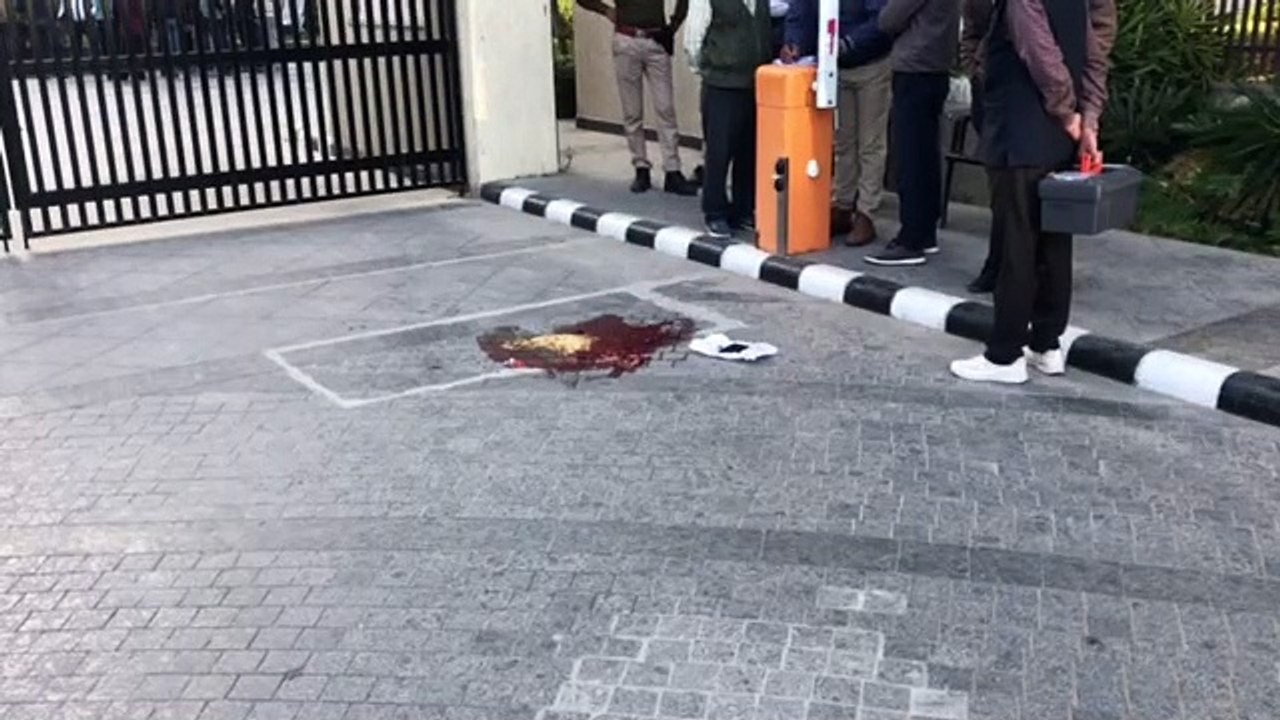 Gun Shot : फायरिंग के बदले फायरिंग : हिस्ट्रीशीटर को गोली मारी