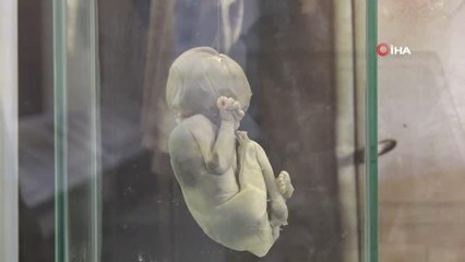 Eski tedavi aletleri bu müzede sergileniyor