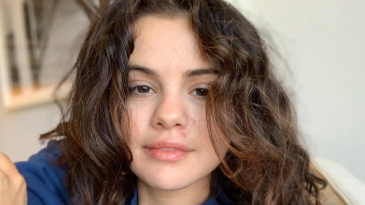 Selena Gomez begeistert ungeschminkt & ohne Filter