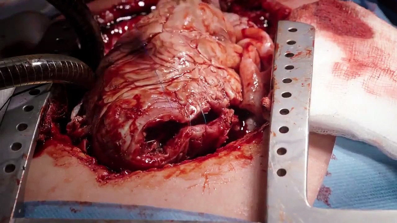 Holby City - Se21 - Ep08 - Never Say Never HD Watch