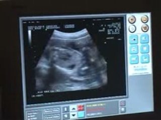 Echo Morpho du 16 janvier 2008