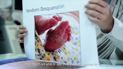 TANYA PAKAR PA&MA  MASALAH KULIT DI KALANGAN BAYI BARU LAHIR