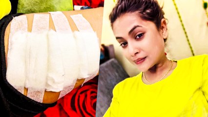 एक्ट्रेस नीलू शंकर सिंह का हुआ एक्सीडेंट, जल्द स्वस्थ होकर लौटेंगी शूटिंग पर