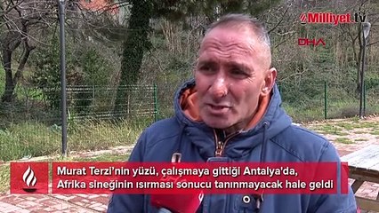 Sinek yüzünü tanınmayacak hale getirdi