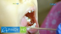 Operation: Dental Checkup, hatid ng Pinoy MD sa isang barangay sa Quezon City! | Pinoy MD