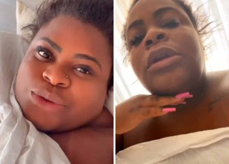 'Já melhorou muito', diz Jojo Todynho ao mostrar resultado de lipo da papada