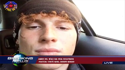 Amici 22, Wax ha una cicatrice  faccia: cos'è quel segno rosso