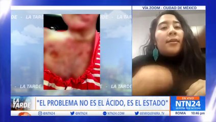 “Lo que las mujeres buscan es que esto no quede en la impunidad”: diputada mexicana por ataques con ácido