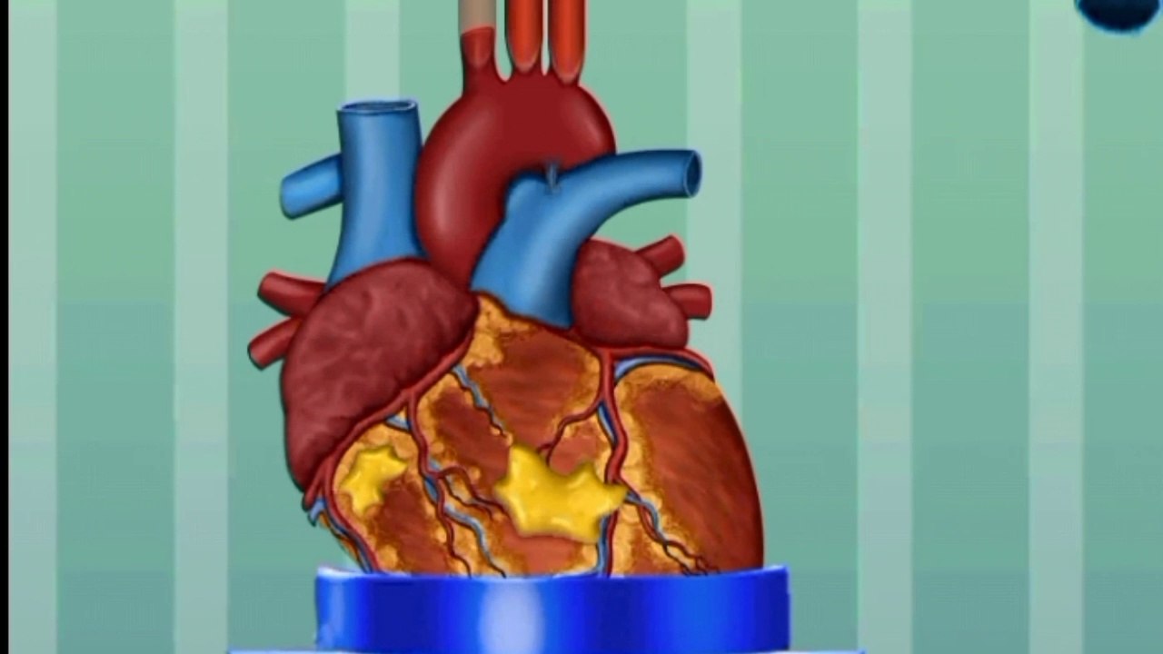 ASMR Treatment of infections caused by wearing facial piercings