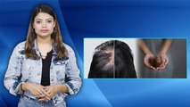 बालों का झड़ना कैसे रोकें, बाल झड़ने के घरेलू उपाय| Hair Fall Home Remedies |Boldsky