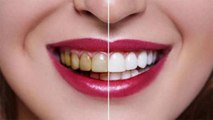 दांतों का पीलापन दूर करने के लिए ऐसे करें सरसों का तेल | दांतों के लिए सरसों तेल के फायदे | Boldsky