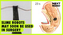 Slime robots may soon be used in surgery | NEXT NOW