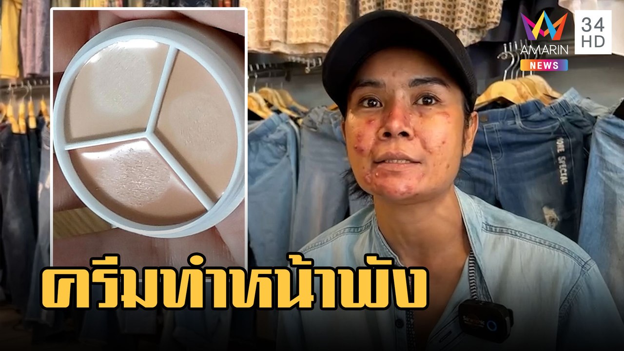 เตือนภัย! ซื้อครีมไร้มาตรฐานจนหน้าพัง | ข่าวเที่ยงอมรินทร์ | 7 ก.พ.66