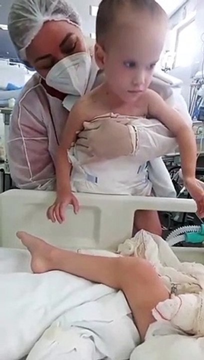 Gémeas siamesas encontram-se pela primeira vez após separação