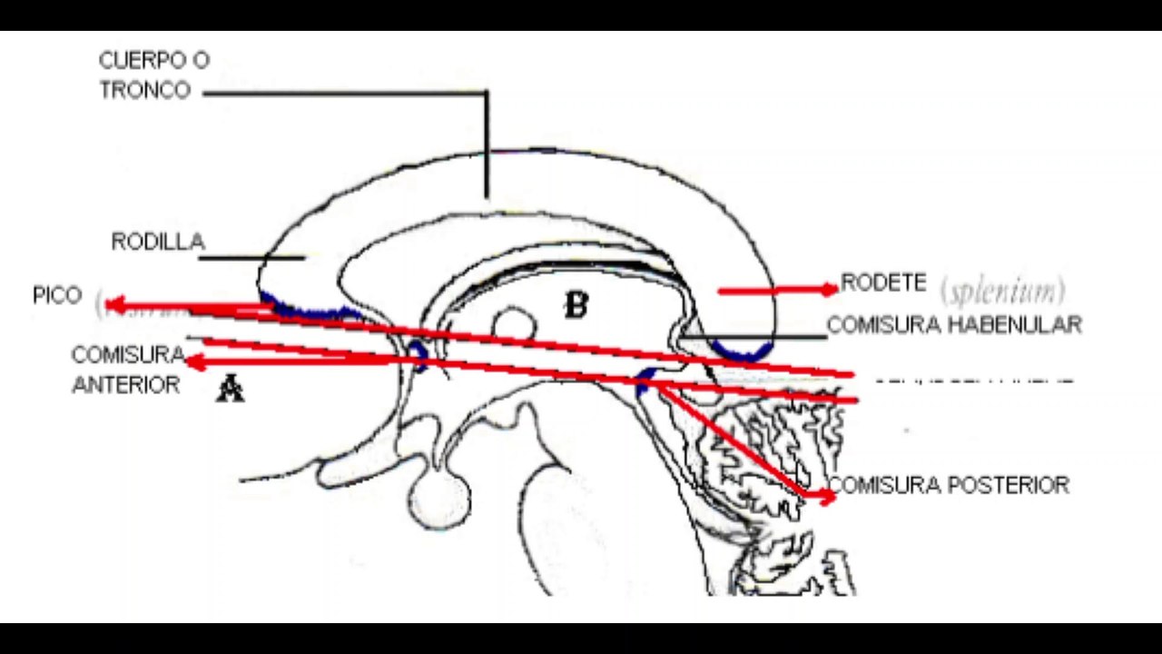 PROTOCOLO BASICO DE CRANEO EN RESONANCIA MAGNETICA