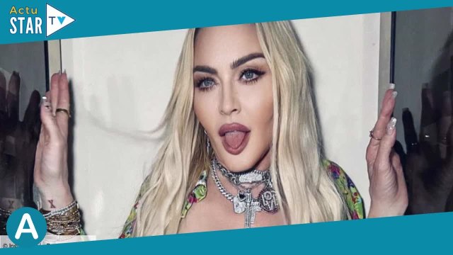 Madonna et la chirurgie esthétique : qu’a-t-elle fait et où ?