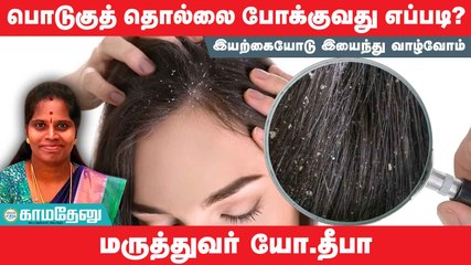 இயற்கை வழி கண்டிஷனர் மூலம் பொடுகுத் தொல்லையைப் போக்கலாமே!