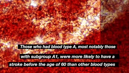 This Blood Type Has a Greater Chance of Stroke Before Age 60