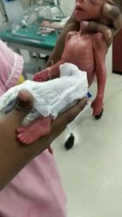 baby of five months  ###weight 400grams ## male baby #soo cute small baby##