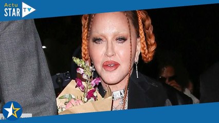 Madonna méconnaissable : elle pousse un gros coup de gueule après les critiques sur son visage
