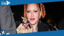 Madonna méconnaissable : elle pousse un gros coup de gueule après les critiques sur son visage