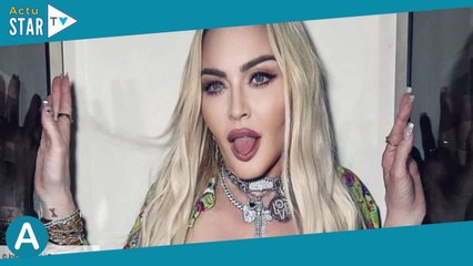 Madonna et la chirurgie esthétique : qu’a-t-elle fait et où ?