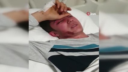 Daha önce beyin tümörünü anlatan depremzede enkazdan da sağ çıkarıldı