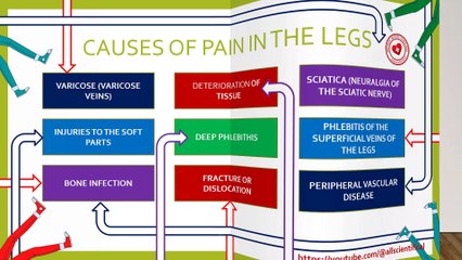 Why do my legs hurt? 9 causes of this problem and how to fix them?