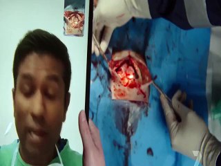 RFDS - Se1 - Ep01 HD Watch