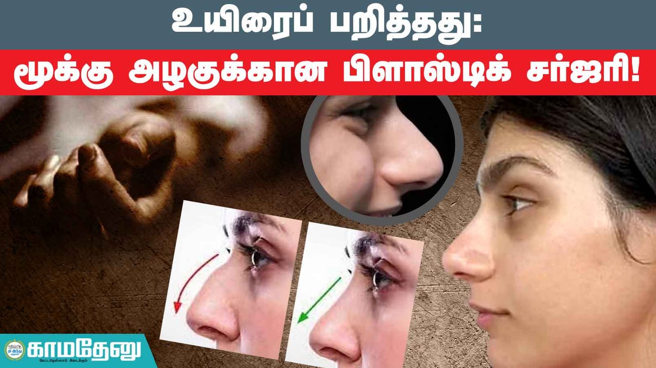 உயிரையும் பறிக்குமா மூக்கு அழகுக்கான பிளாஸ்டிக் சர்ஜரி?