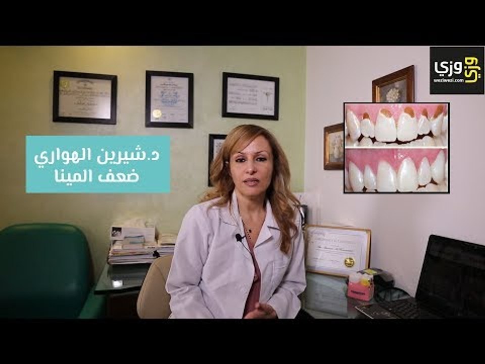 ضعف طبقة المينا في الأسنان وطريقة العلاج