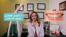 تبييض الأسنان في العيادة