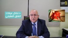الفتق الإربي (الفتق المغبني) وطريقة علاجه