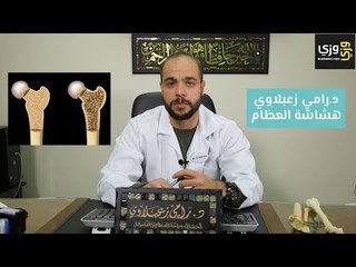 أسباب وأعراض هشاشة العظام وكيفية علاجها
