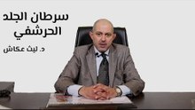 سرطان الجلد الحرشفي