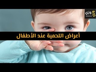 أهم أعراض اللحمية عند الأطفال