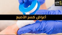 أهم أعراض كسر الأصبع