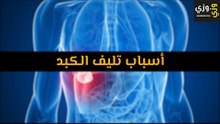 أهم أسباب تليف الكبد