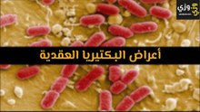 أهم أعراض البكتيريا العقدية