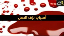 أهم أسباب نزيف الحمل