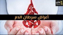 أهم أعراض سرطان الدم