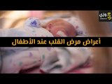 أهم أعراض مرض القلب عند الأطفال