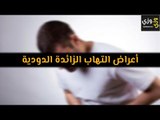 أهم أعراض التهاب الزائدة الدودية
