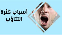 أهم أسباب كثرة التثاؤب