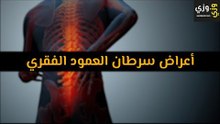 أهم أعراض سرطان العمود الفقري