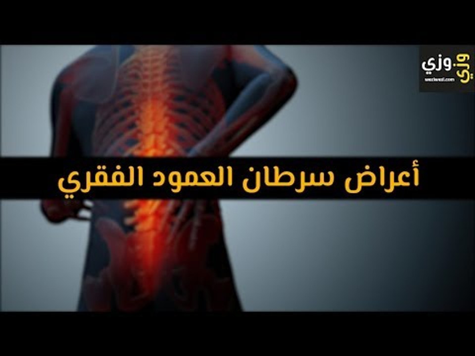 أهم أعراض سرطان العمود الفقري
